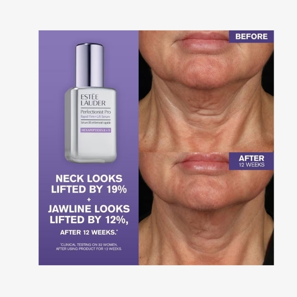Estée Lauder Perfectionist Pro Rapid Firm + Lift Treatment Serum - Picture 4 of 14